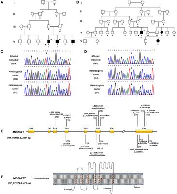 Phenotypic Characterization of Intellectual Disability Caused by MBOAT7 Mutation in Two Consanguineous Pakistani Families